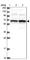 Trichoplein Keratin Filament Binding antibody, HPA038638, Atlas Antibodies, Western Blot image 