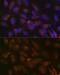 Insulin Like Growth Factor Binding Protein 7 antibody, GTX03198, GeneTex, Immunocytochemistry image 