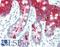 Keratin 20 antibody, LS-B10198, Lifespan Biosciences, Immunohistochemistry paraffin image 