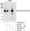 Thyroid Hormone Receptor Associated Protein 3 antibody, A300-955A, Bethyl Labs, Immunoprecipitation image 