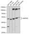 Mitogen-Activated Protein Kinase Kinase 5 antibody, 22-583, ProSci, Western Blot image 
