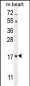 Fibroblast Growth Factor 16 antibody, PA5-48297, Invitrogen Antibodies, Western Blot image 