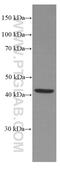 Transcobalamin 2 antibody, 66377-1-Ig, Proteintech Group, Western Blot image 