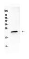 Transmembrane Protein 107 antibody, PA5-80138, Invitrogen Antibodies, Western Blot image 