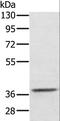 Aldo-Keto Reductase Family 1 Member C4 antibody, LS-C405059, Lifespan Biosciences, Western Blot image 