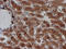 Crystallin Zeta Like 1 antibody, M16122, Boster Biological Technology, Immunohistochemistry paraffin image 
