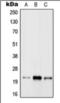 RAB31, Member RAS Oncogene Family antibody, orb376115, Biorbyt, Western Blot image 