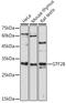 General Transcription Factor IIB antibody, GTX66408, GeneTex, Western Blot image 