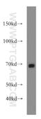 Ectonucleoside Triphosphate Diphosphohydrolase 4 antibody, 19597-1-AP, Proteintech Group, Western Blot image 