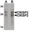 Cysteine Rich Secretory Protein 2 antibody, PA5-21007, Invitrogen Antibodies, Western Blot image 