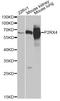 Purinergic Receptor P2X 4 antibody, A6682, ABclonal Technology, Western Blot image 