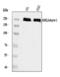 Ankyrin-1 antibody, A02716-1, Boster Biological Technology, Western Blot image 