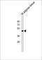 Tenomodulin antibody, 64-230, ProSci, Western Blot image 