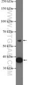 VPS26, Retromer Complex Component A antibody, 12804-1-AP, Proteintech Group, Western Blot image 