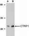 C1q And TNF Related 1 antibody, NBP1-76626, Novus Biologicals, Western Blot image 