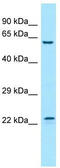 Fibroblast Growth Factor 17 antibody, TA338202, Origene, Western Blot image 