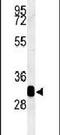 Retinol Dehydrogenase 16 antibody, PA5-25370, Invitrogen Antibodies, Western Blot image 