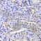 Proteasome Subunit Alpha 6 antibody, A2188, ABclonal Technology, Immunohistochemistry paraffin image 
