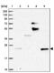 StAR Related Lipid Transfer Domain Containing 5 antibody, PA5-59241, Invitrogen Antibodies, Western Blot image 