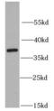 Ribosomal Protein Lateral Stalk Subunit P0 antibody, FNab07448, FineTest, Western Blot image 