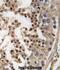 Cyclin Dependent Kinase 14 antibody, abx033468, Abbexa, Immunohistochemistry frozen image 