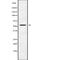 Gasdermin E antibody, abx149796, Abbexa, Western Blot image 