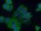 Papillary thyroid carcinoma-encoded protein antibody, 13717-1-AP, Proteintech Group, Immunofluorescence image 