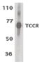 Interleukin 27 Receptor Subunit Alpha antibody, PA5-19984, Invitrogen Antibodies, Western Blot image 