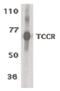 Interleukin 27 Receptor Subunit Alpha antibody, PA5-19984, Invitrogen Antibodies, Western Blot image 