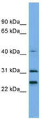Histone Cluster 1 H1 Family Member E antibody, TA344387, Origene, Western Blot image 