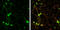 Discs Large MAGUK Scaffold Protein 3 antibody, GTX133279, GeneTex, Immunocytochemistry image 