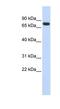 Ankyrin Repeat Domain 13B antibody, NBP1-91433, Novus Biologicals, Western Blot image 