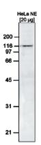 SWI/SNF Related, Matrix Associated, Actin Dependent Regulator Of Chromatin, Subfamily A, Member 5 antibody, MA5-23512, Invitrogen Antibodies, Western Blot image 