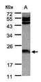 Ferritin Light Chain antibody, GTX101211, GeneTex, Western Blot image 