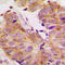 Ribosomal Protein S6 Kinase B1 antibody, LS-C352824, Lifespan Biosciences, Immunohistochemistry frozen image 