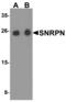 Small Nuclear Ribonucleoprotein Polypeptide N antibody, PA5-72858, Invitrogen Antibodies, Western Blot image 
