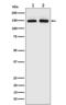 Phosphoinositide-3-Kinase Regulatory Subunit 4 antibody, M06618-1, Boster Biological Technology, Western Blot image 