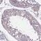 TCAL8 antibody, HPA059115, Atlas Antibodies, Immunohistochemistry paraffin image 