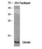 Ghrelin And Obestatin Prepropeptide antibody, STJ93265, St John