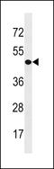 Chromodomain Y-Linked 1B antibody, LS-C159328, Lifespan Biosciences, Western Blot image 