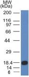 c-Kit antibody, GTX34608, GeneTex, Western Blot image 
