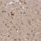 Ribosomal Protein S6 antibody, NBP1-87099, Novus Biologicals, Immunohistochemistry paraffin image 