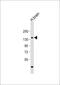 Adenylate cyclase type 8 antibody, 63-675, ProSci, Western Blot image 