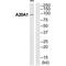 Ankyrin Repeat Domain 20 Family Member A1 antibody, A18646, Boster Biological Technology, Western Blot image 