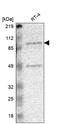 RPA1 Related Single Stranded DNA Binding Protein, X-Linked antibody, HPA000896, Atlas Antibodies, Western Blot image 