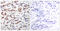 Signal Transducer And Activator Of Transcription 5A antibody, LS-C117485, Lifespan Biosciences, Immunohistochemistry paraffin image 