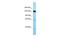 Elastin Microfibril Interfacer 1 antibody, A06720, Boster Biological Technology, Western Blot image 