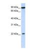 Transmembrane And Tetratricopeptide Repeat Containing 4 antibody, NBP1-59824, Novus Biologicals, Western Blot image 