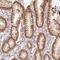 Activin A Receptor Type 1B antibody, NBP2-39003, Novus Biologicals, Immunohistochemistry paraffin image 
