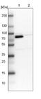 Methylmalonyl-CoA Mutase antibody, NBP1-87423, Novus Biologicals, Western Blot image 